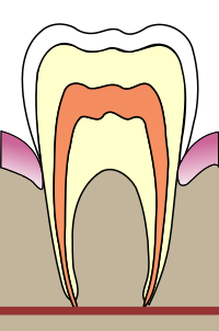 schematic of a tooth